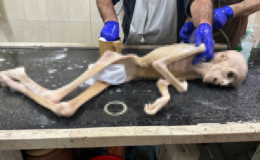 Gazze’de 10 yaşındaki çocuk açlıktan hayatını kaybetti!