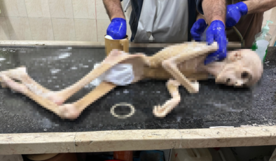 Gazze’de 10 yaşındaki çocuk açlıktan hayatını kaybetti!