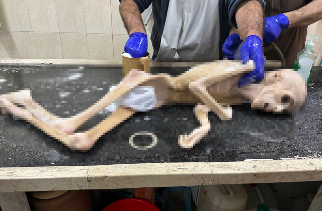 Gazze’de 10 yaşındaki çocuk açlıktan hayatını kaybetti!